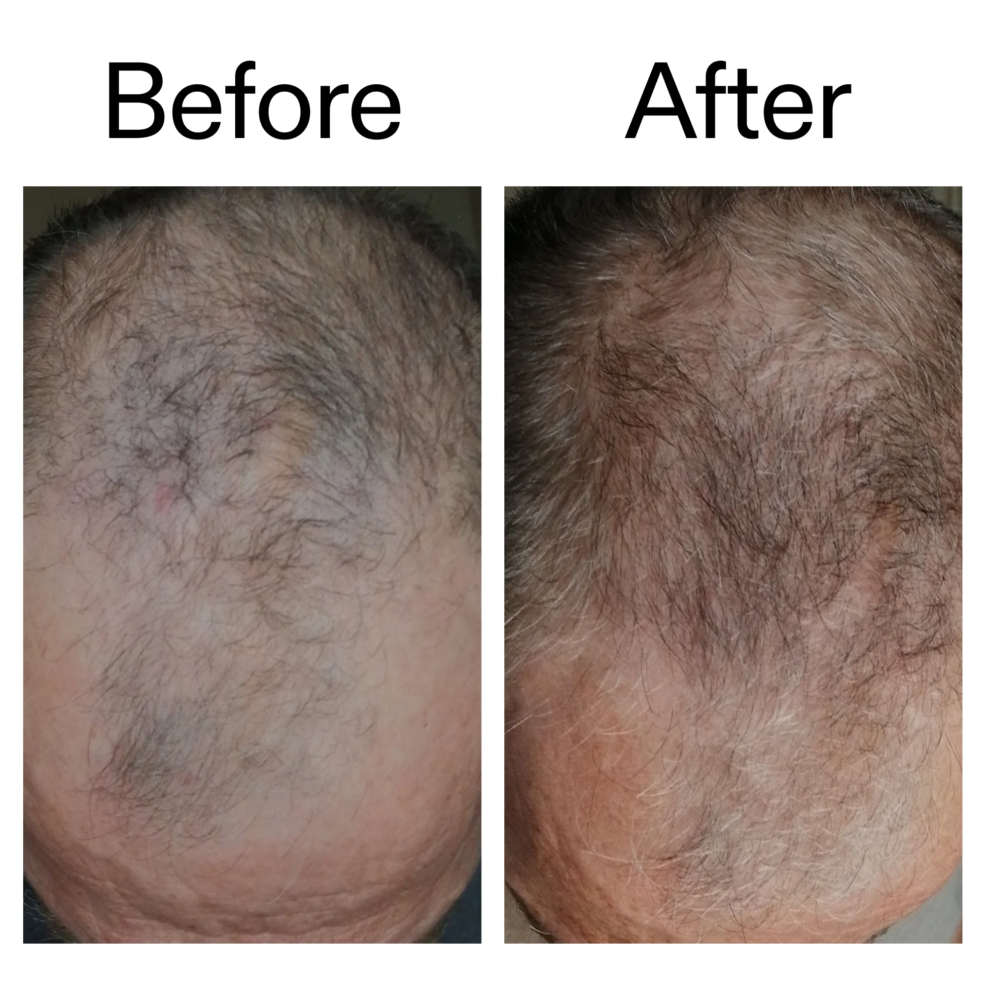 Caffeine stimulating scalp treatment - Image 7