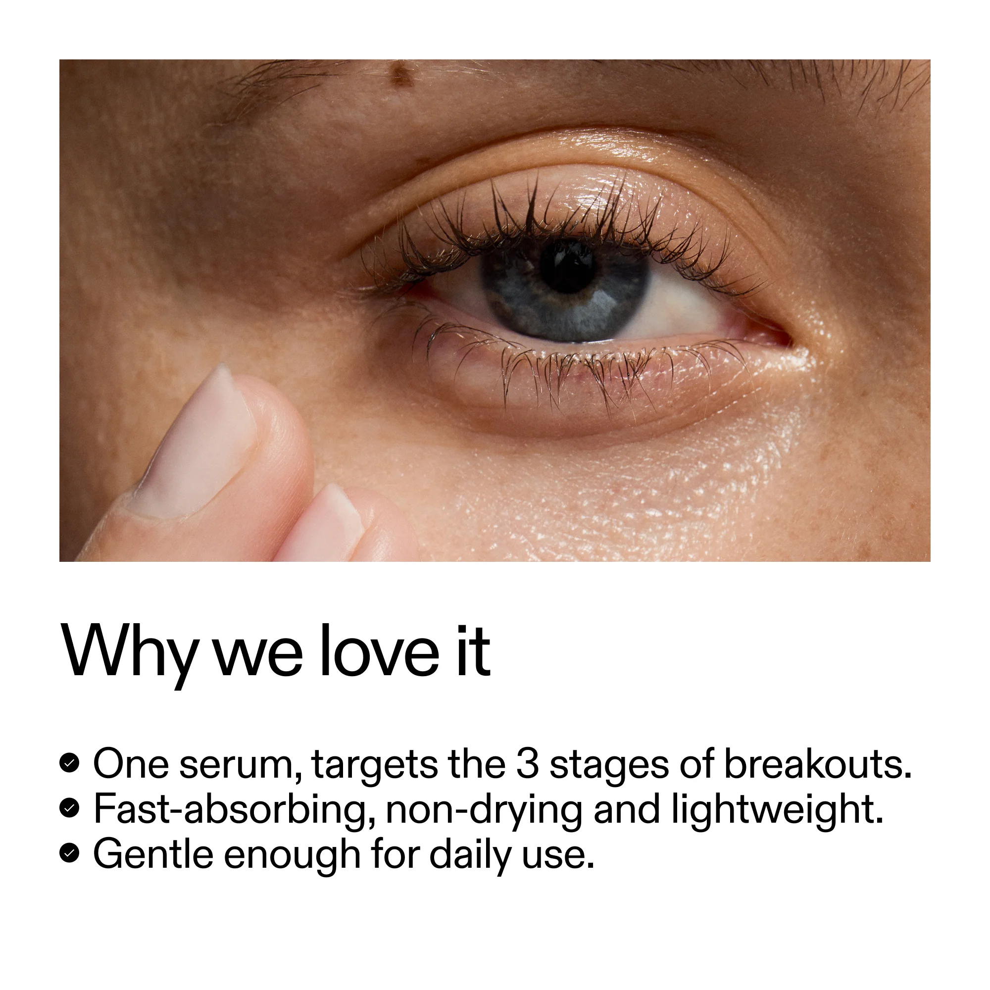 360° Skin Clearing Serum - Image 4
