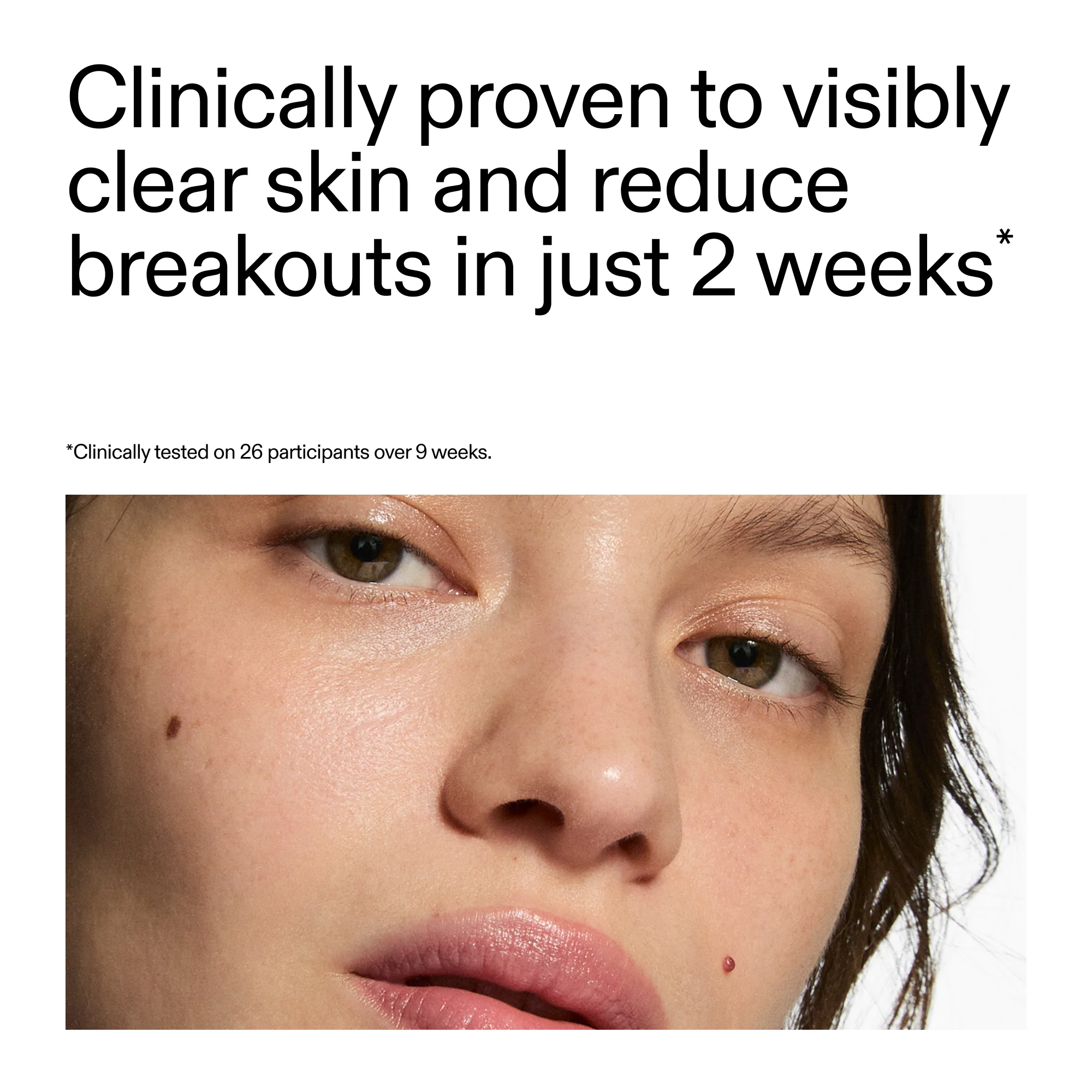 360° Skin Clearing Serum - Image 5