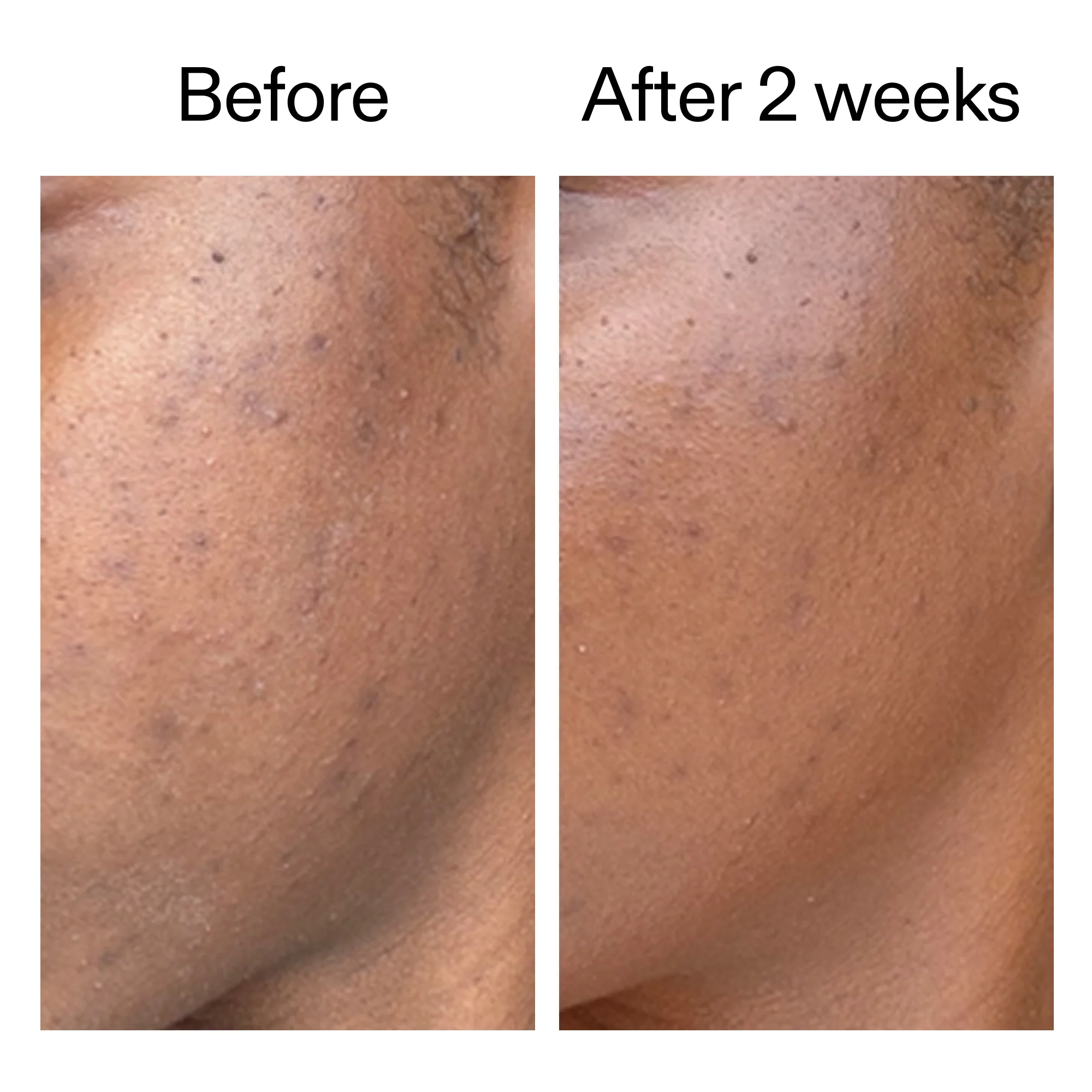 360° Skin Clearing Serum - Image 6