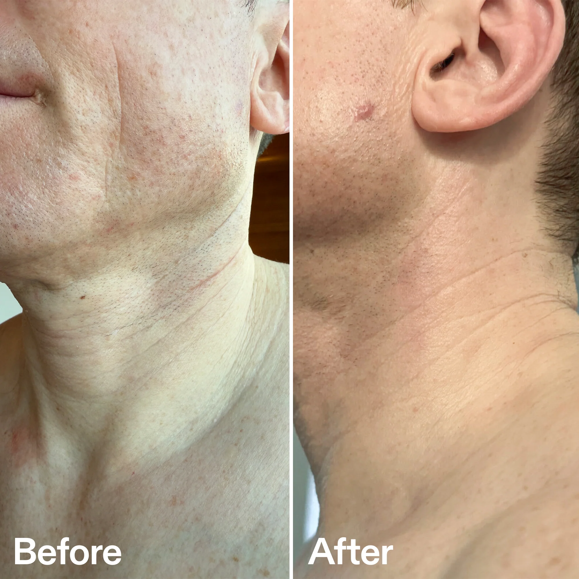 Bio-Active Neck Lift Stick - Image 8