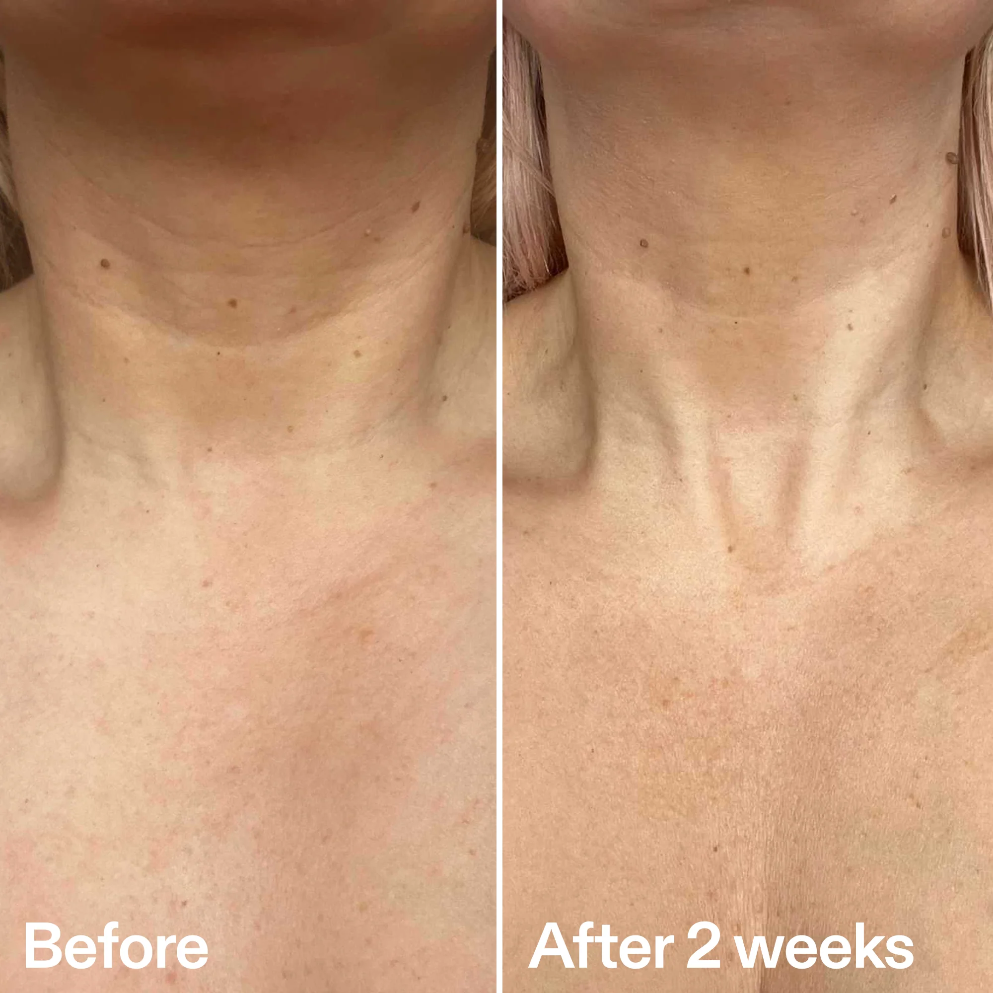 Bio-Active Neck Lift Stick - Image 9