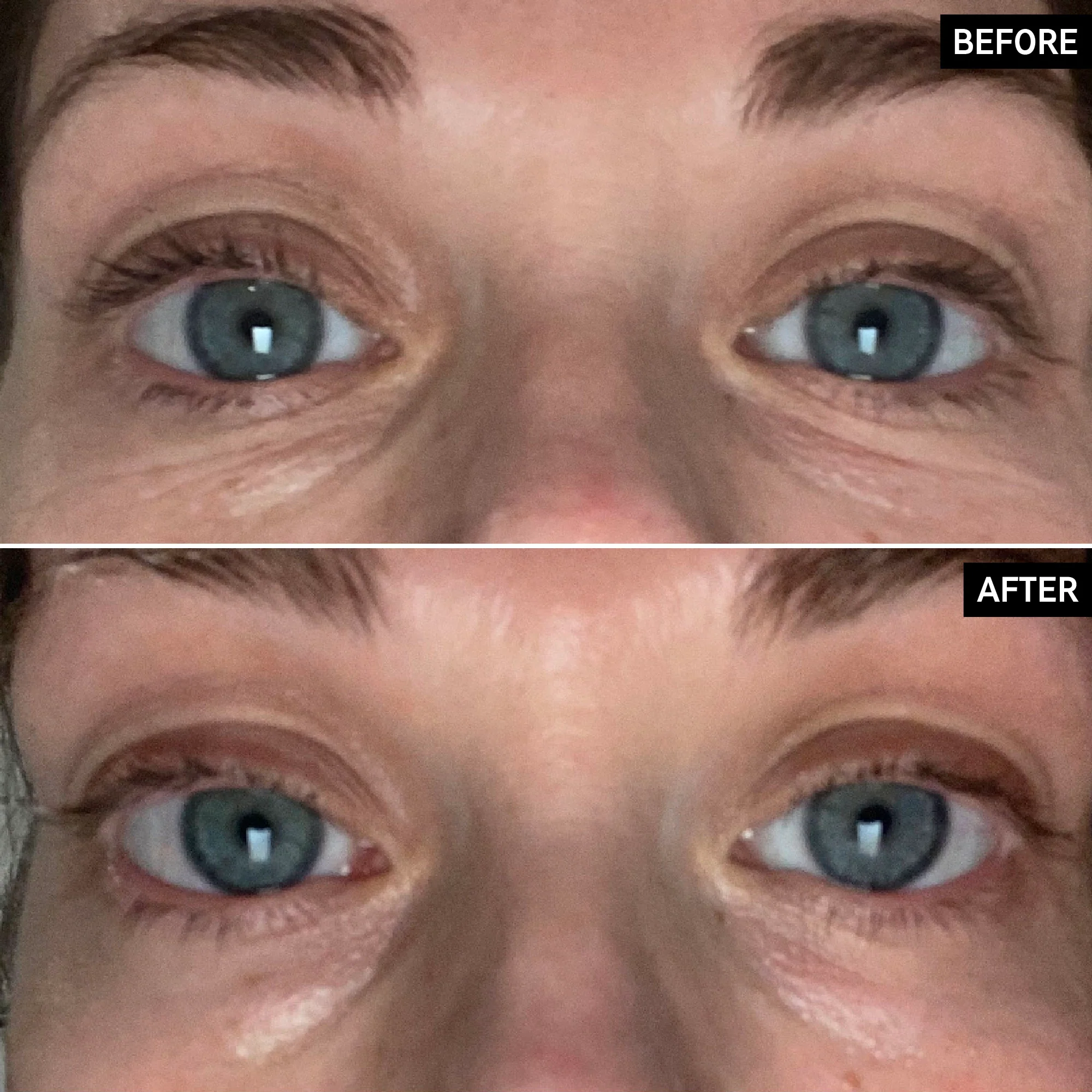 Brighten-i Eye Cream - Image 8