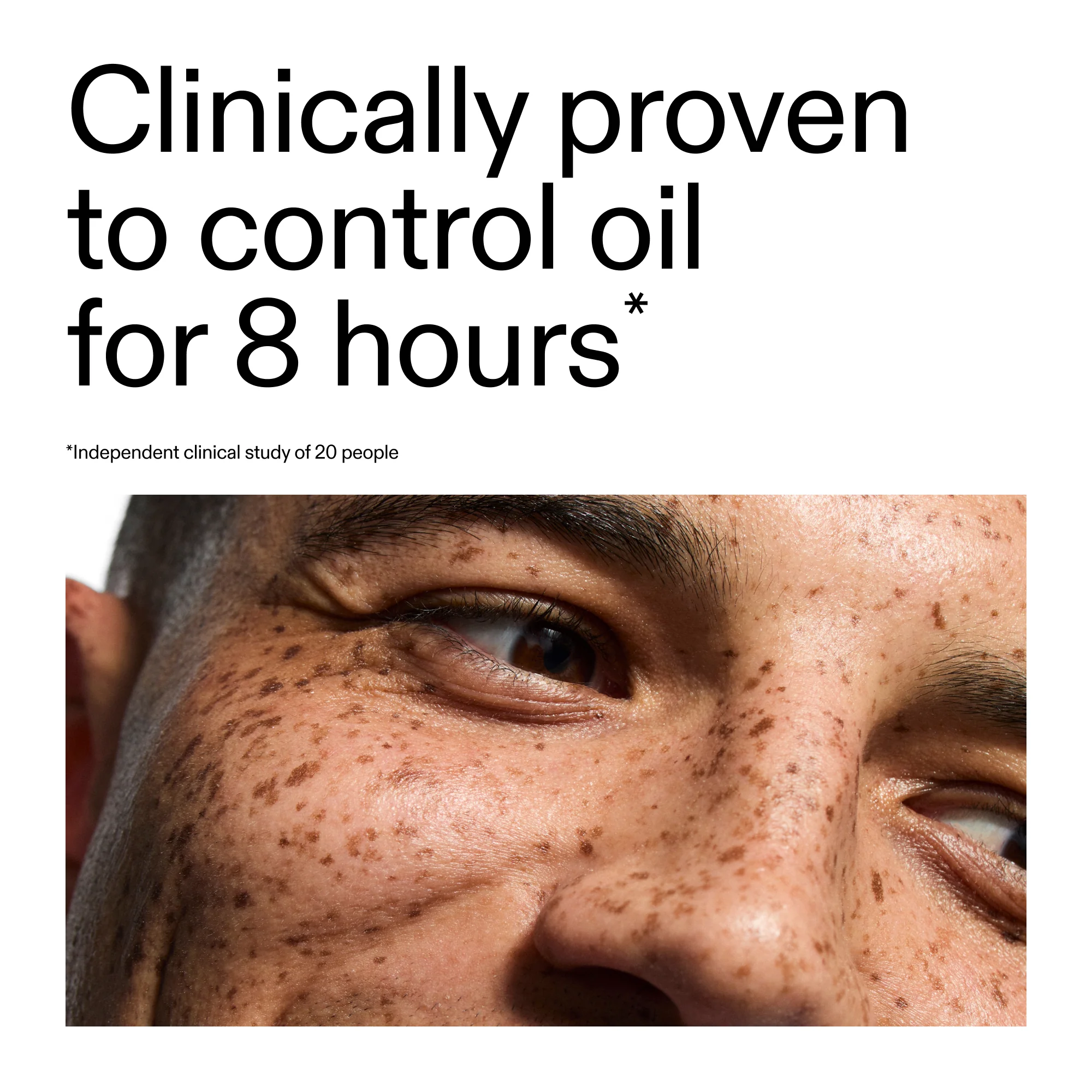 20% Niacinamide Serum - Image 5