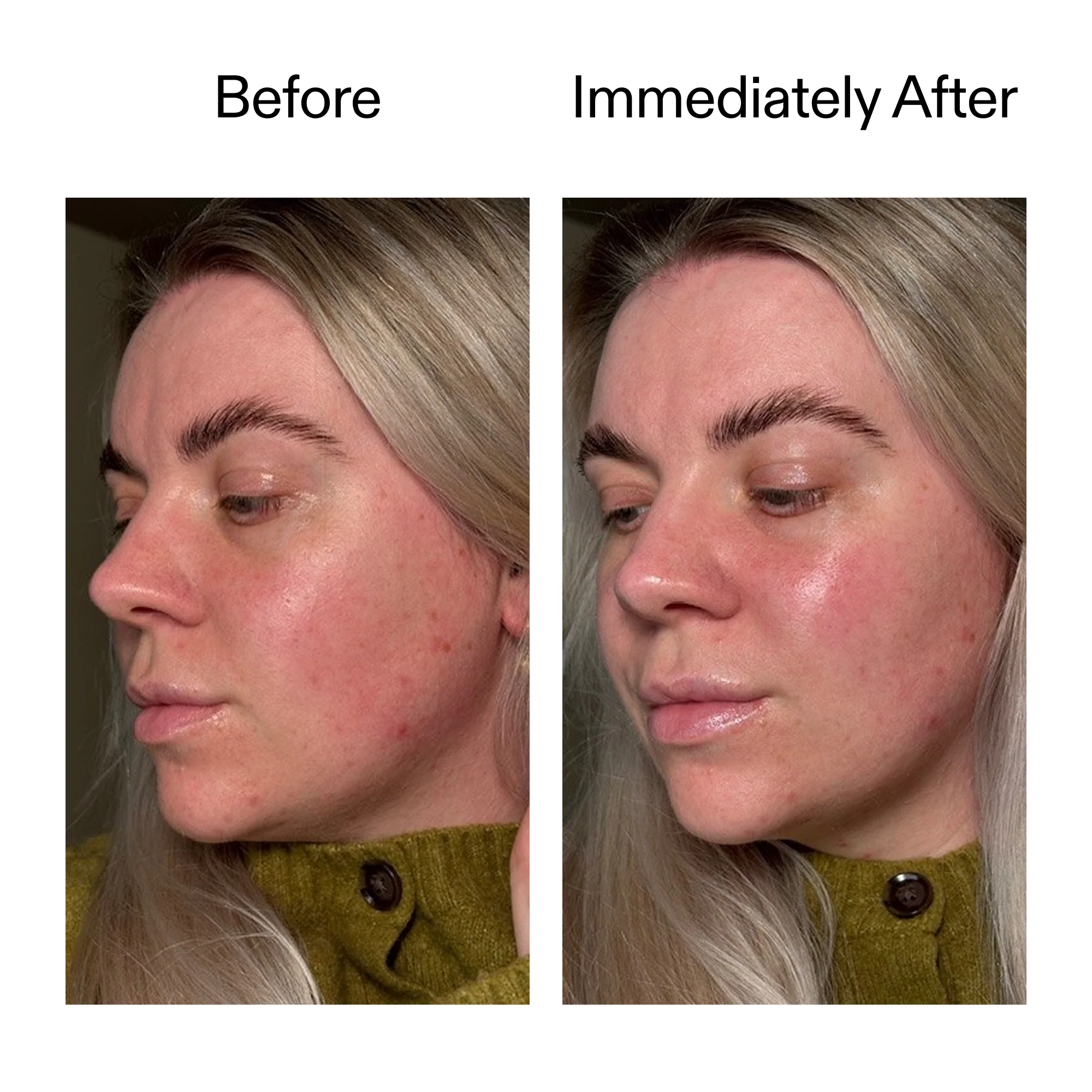 Exosome Glow Serum - Image 10