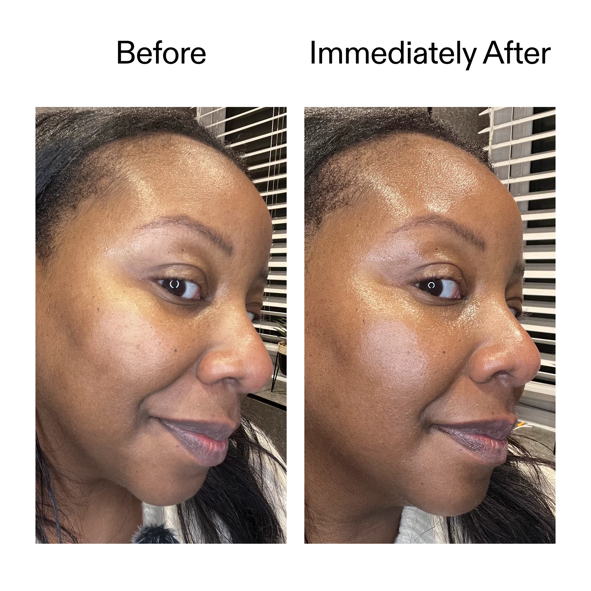 Exosome Glow Serum - Image 11