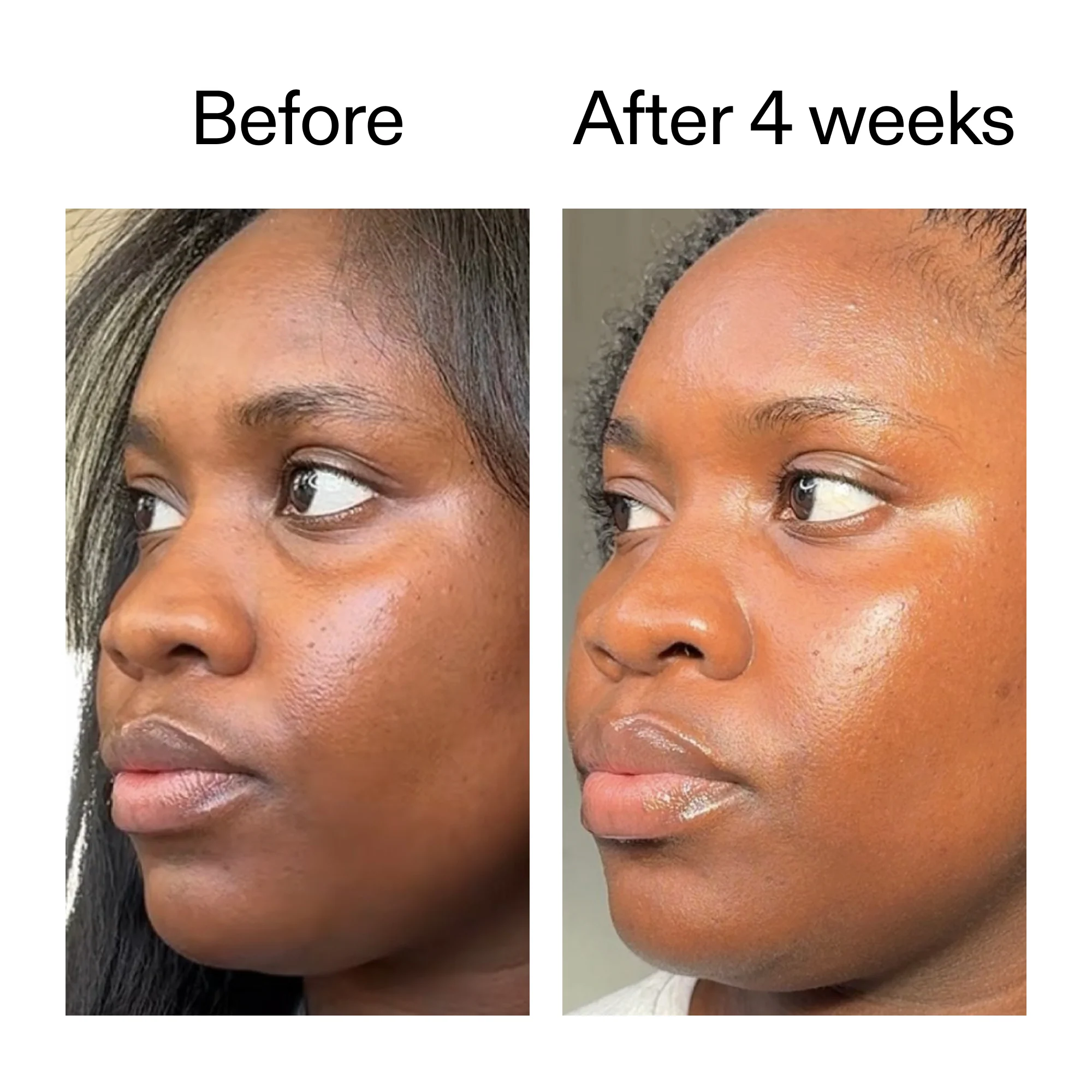 Exosome Glow Serum - Image 12