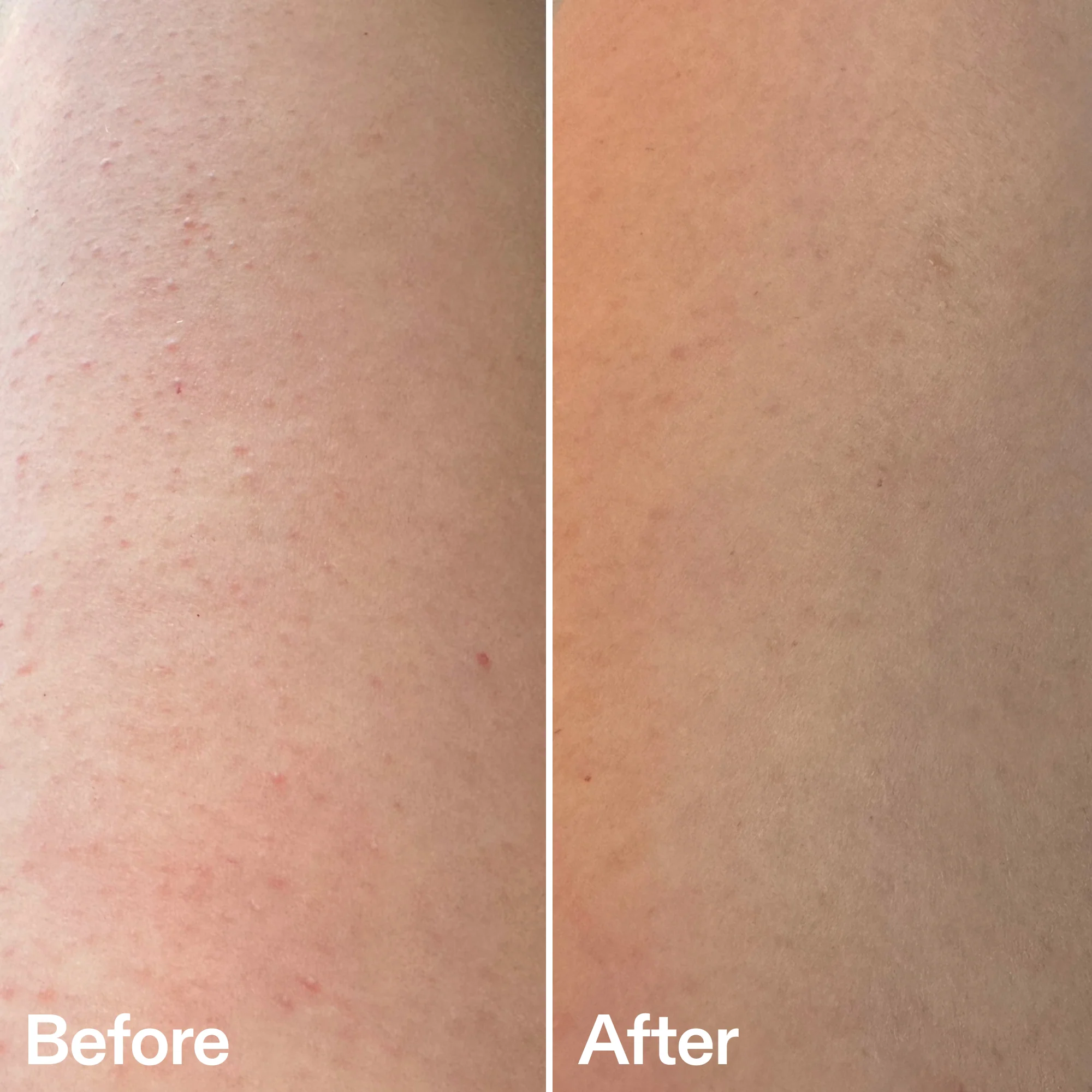 Glycolic Acid Exfoliating Body Wash - Image 7