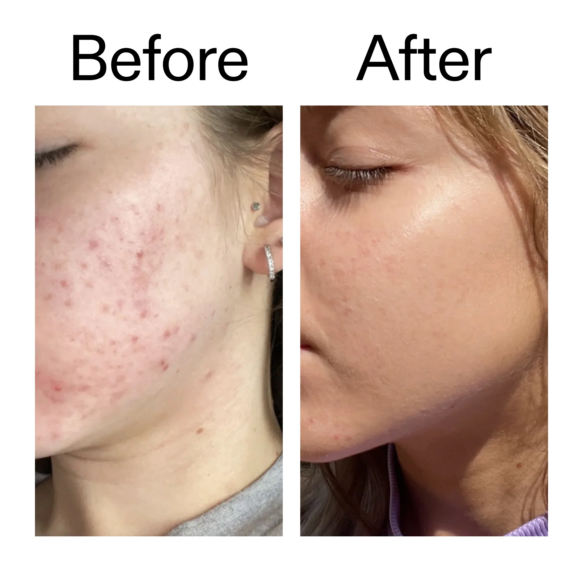 10% Niacinamide Serum - Image 8
