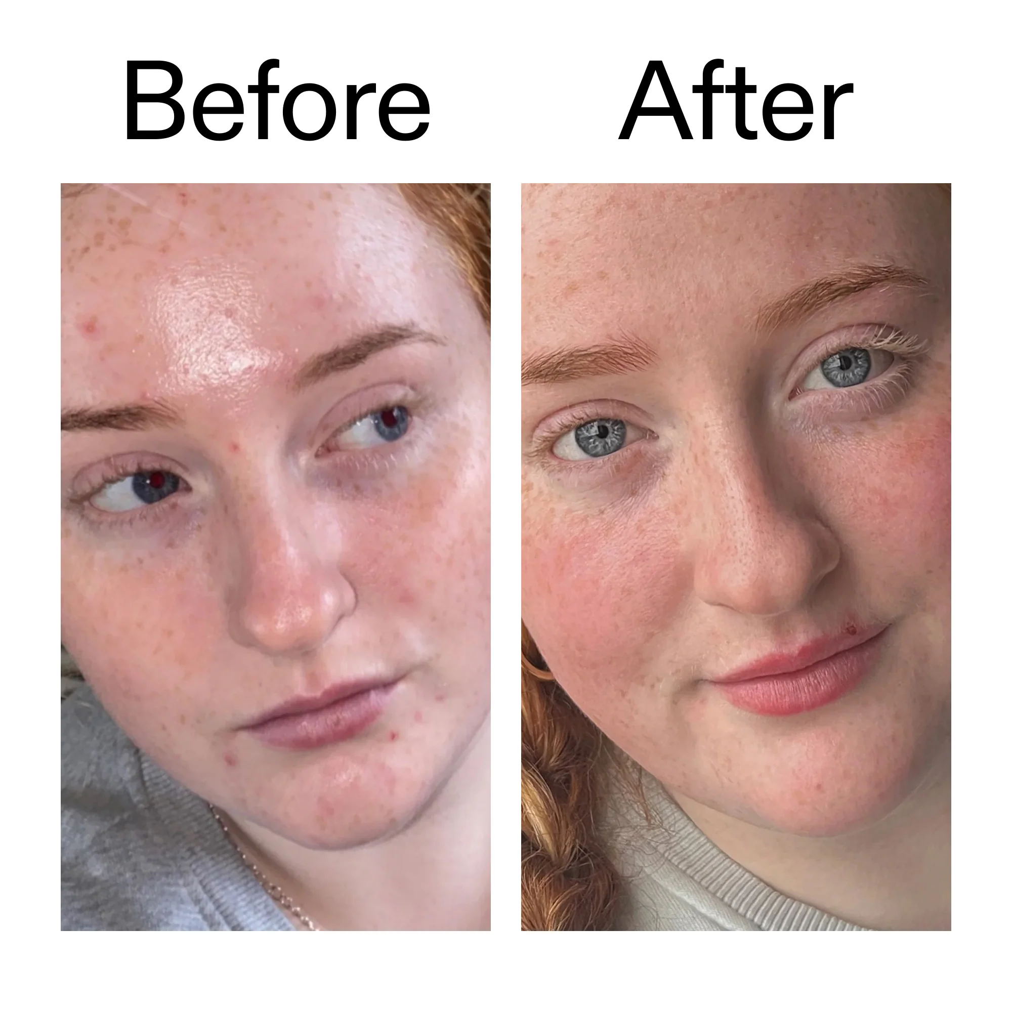 Vitamin B, C and E Moisturiser - Image 8