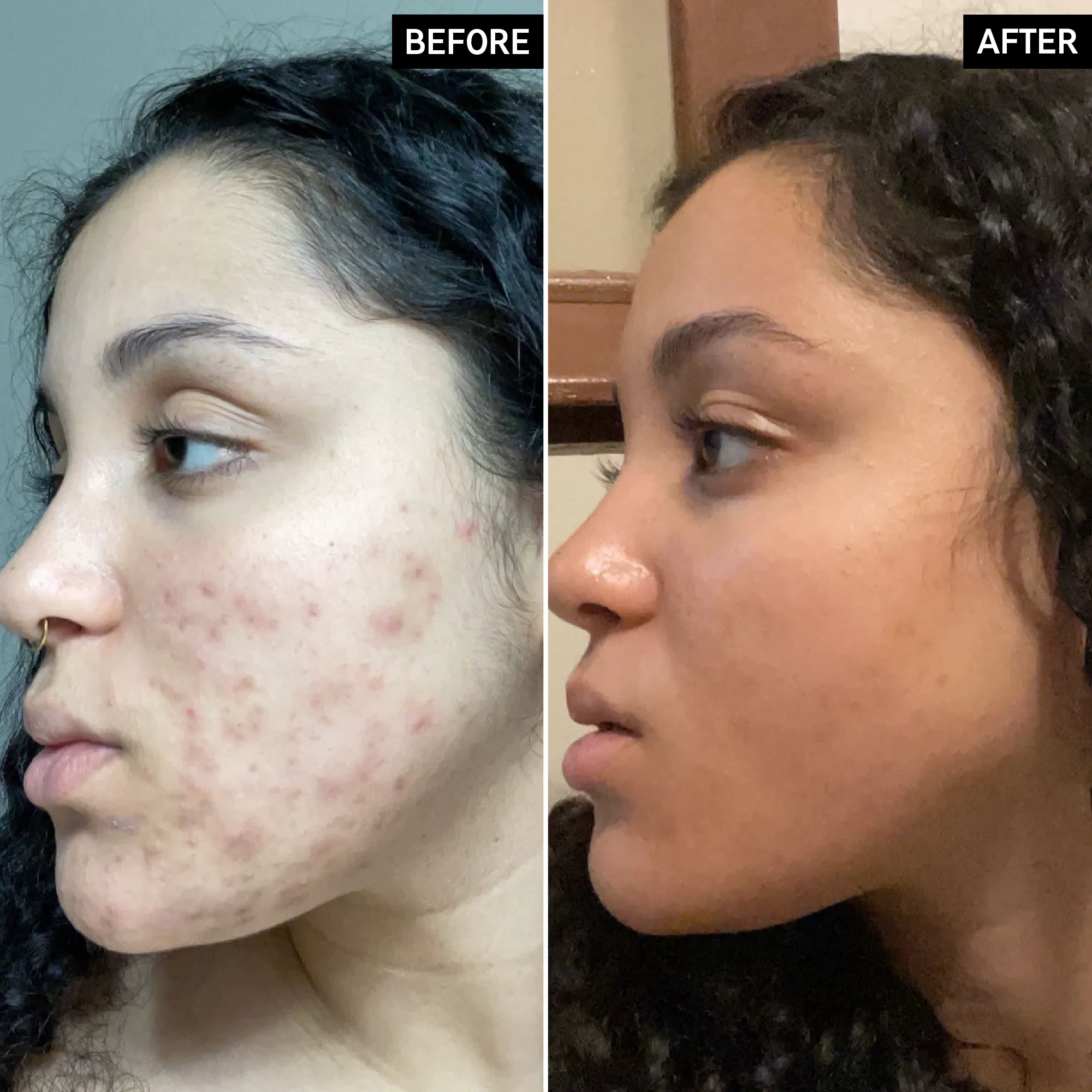 Vitamin C Serum - Image 4